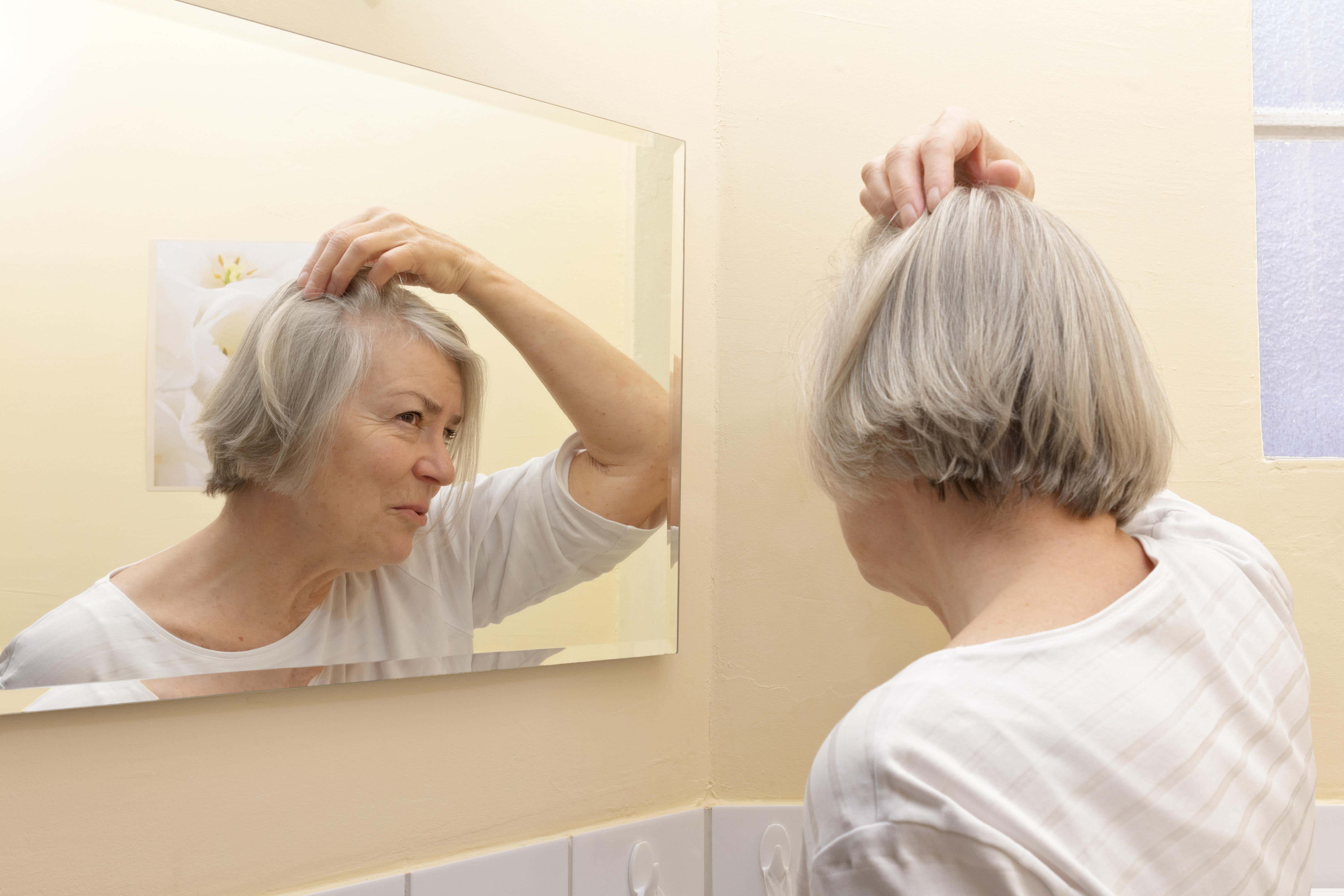 <p>Grey hair is an inevitable hallmark of ageing</p>