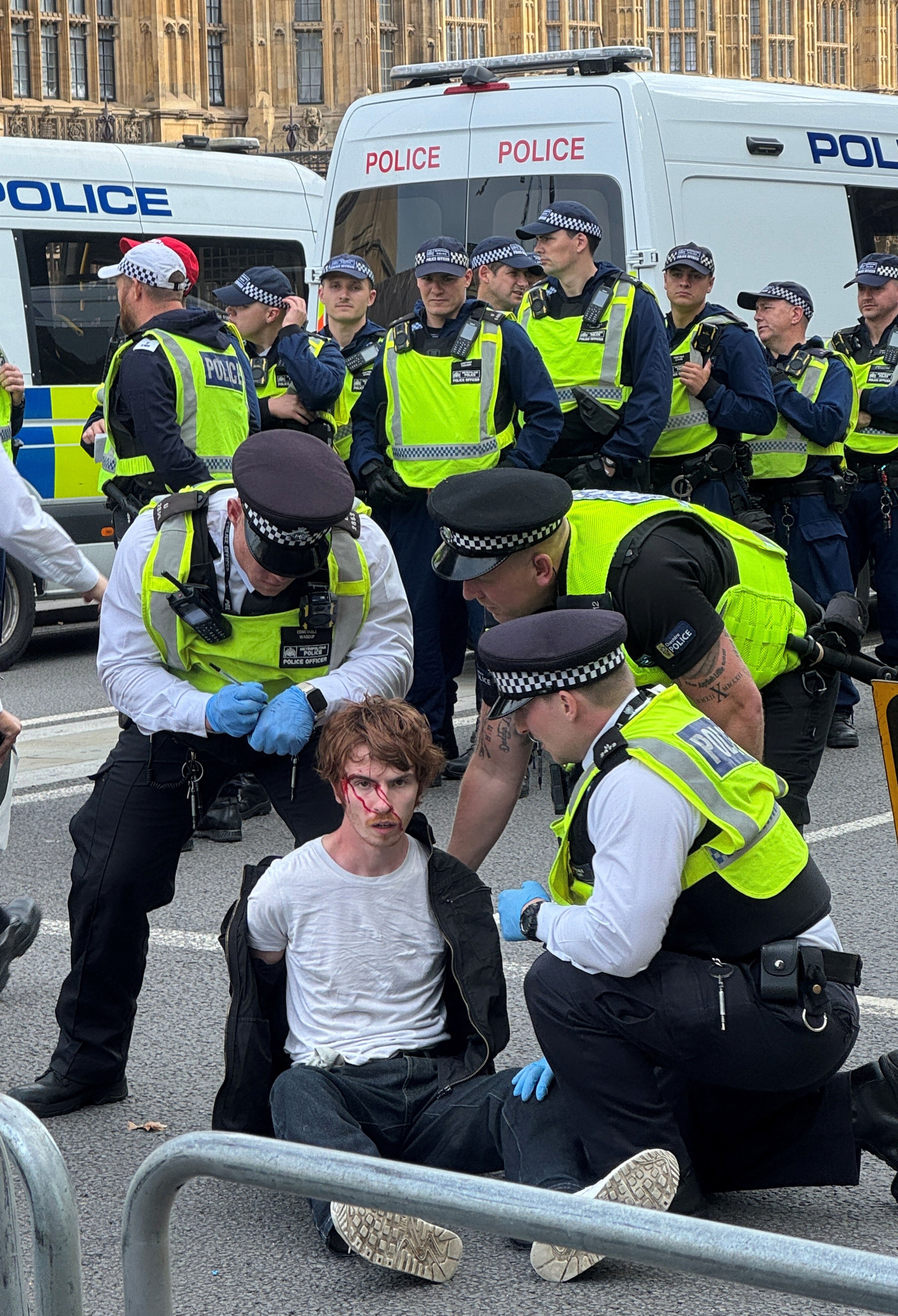 A protester with blood streaming down his face after clashes erupted