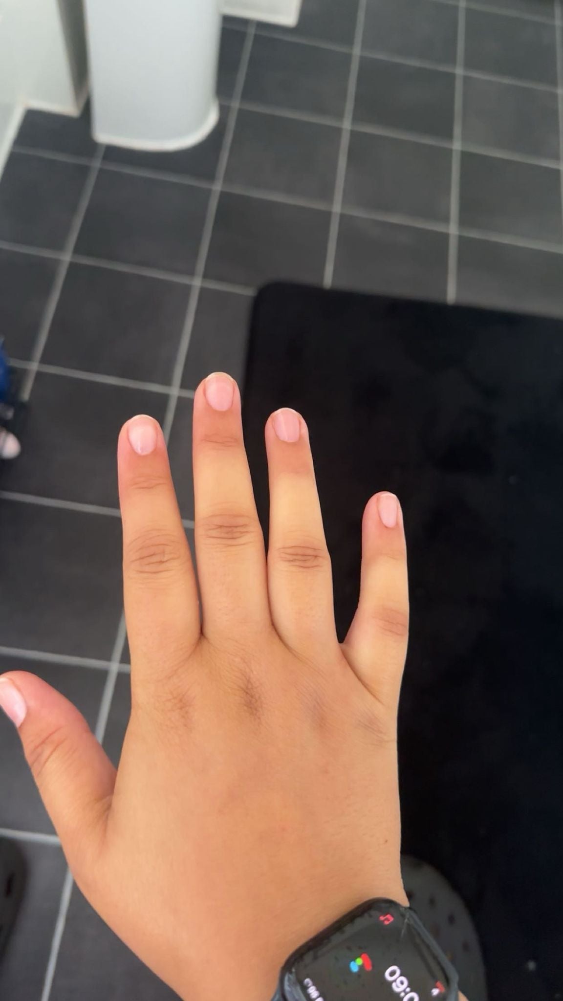 Mrs. Rey noticed that her fingers were swollen before diagnosis