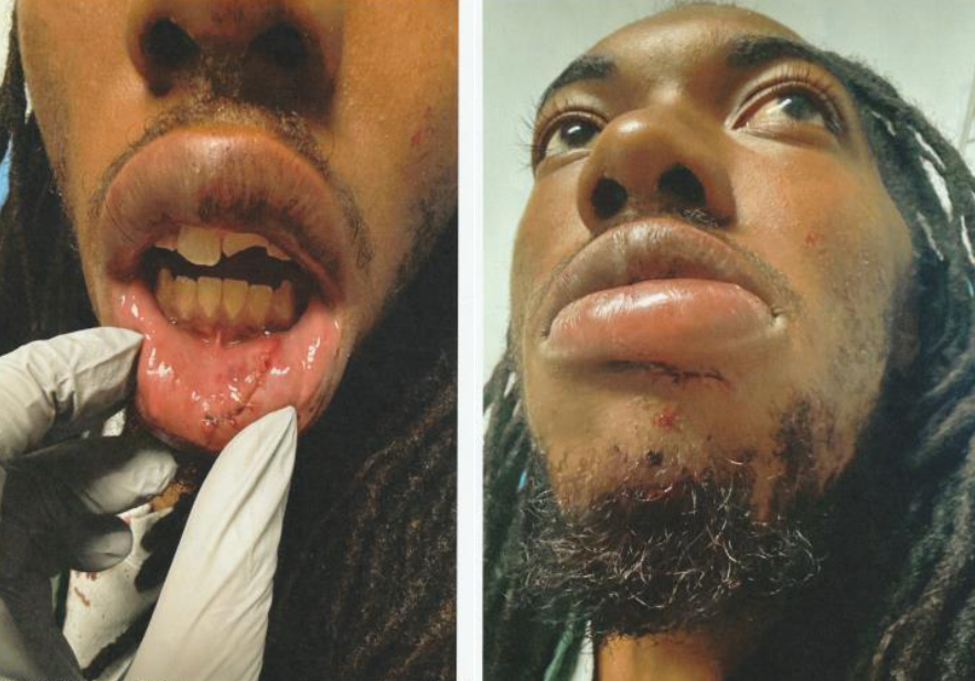 William McNeil Jr, a 22-year-old man who went viral after video showed Florida police smashing his car window and punching him multiple times in the face, has sued the city and the sheriff’s department. The altercation in February resulted in lacerations to his chin and lip, a fractured tooth, and a close head injury and he has been diagnosed with ‘an ongoing traumatic brain injury’ following the incident