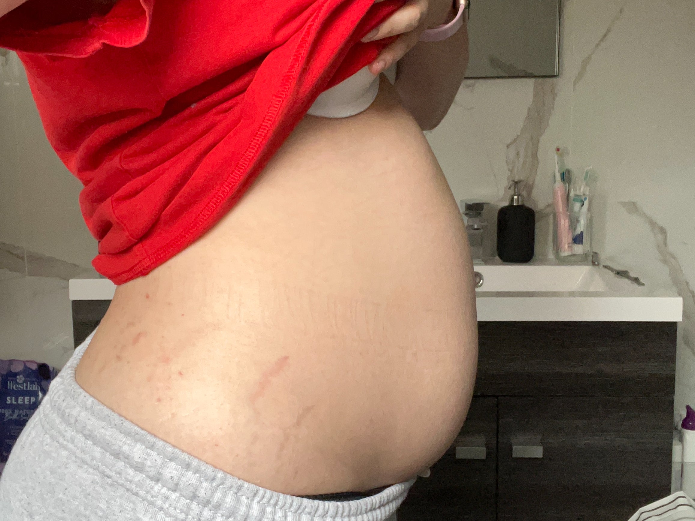 Natasha Reynolds had developed a 20cm tumour yet doctors told her she had IBS