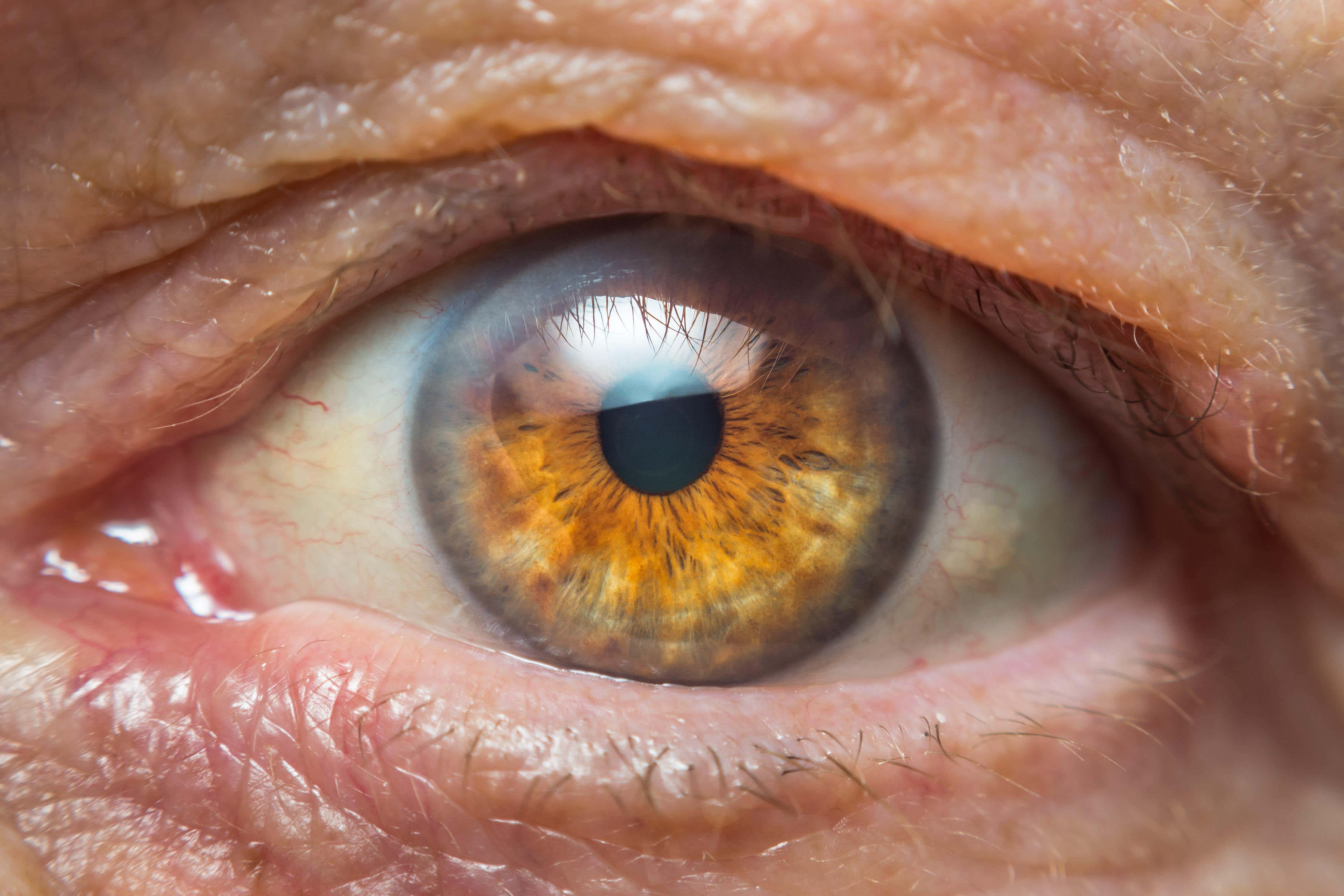 Cataract surgery on both eyes can be carried out safely at the same time, a study suggests (PA)