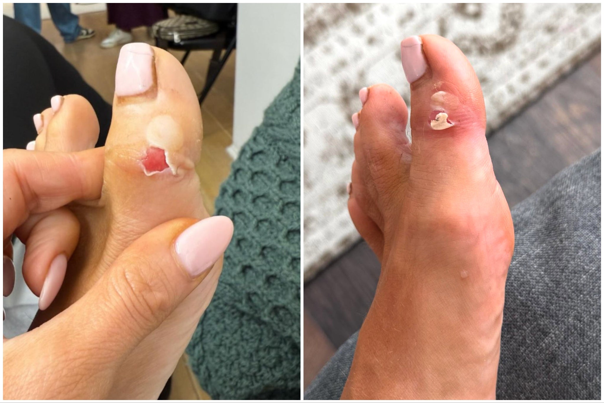 ‘I’ll have no skin at all left on my feet soon,’ said the star