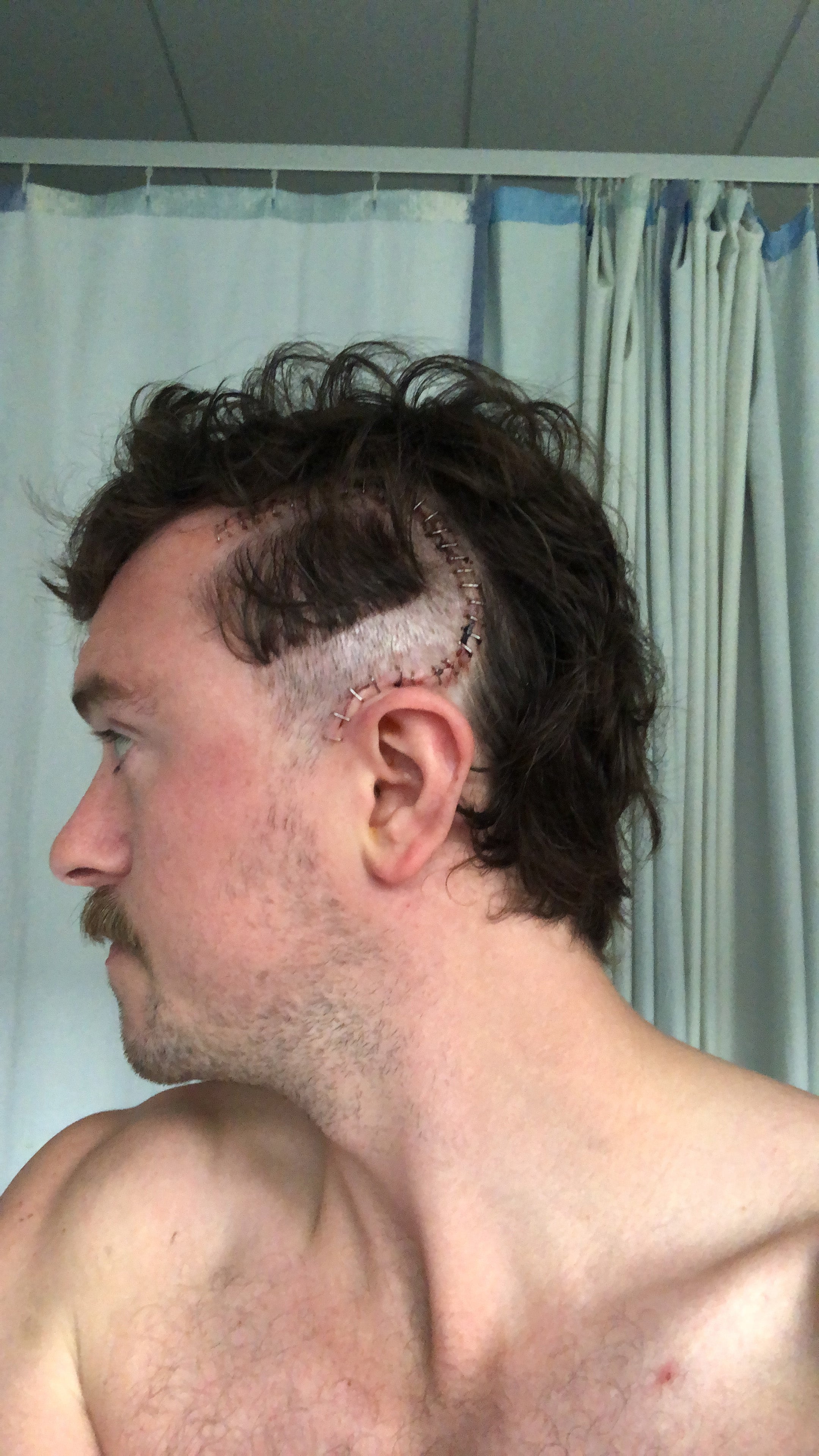 Iain has been sharing his experiences on social media, where he has built a following of more than 14 million people while raising awareness about the realities of living with a terminal illness