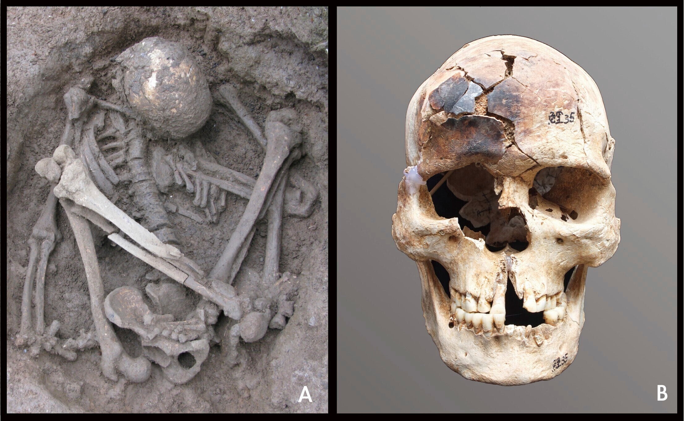 Researchers uncovered blackened bones