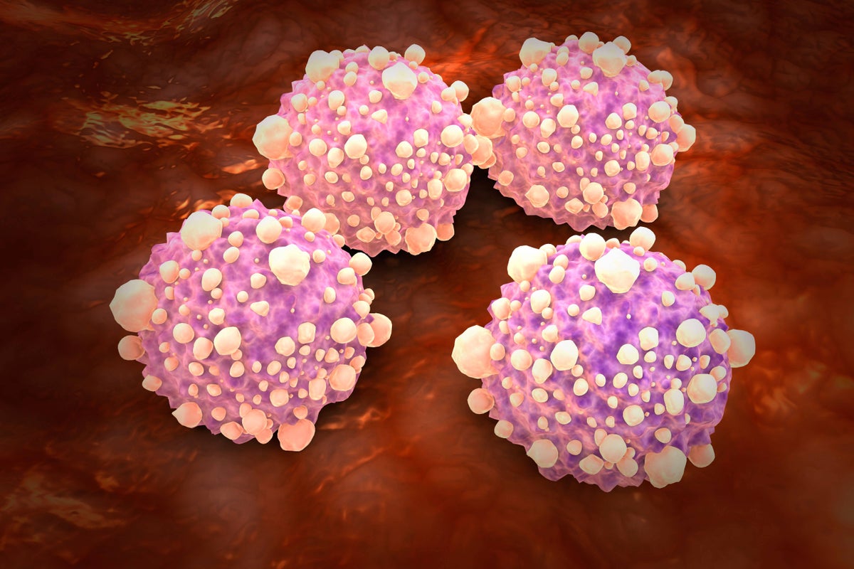 Daily pill almost doubles survival time for pancreatic cancer patients in new trial