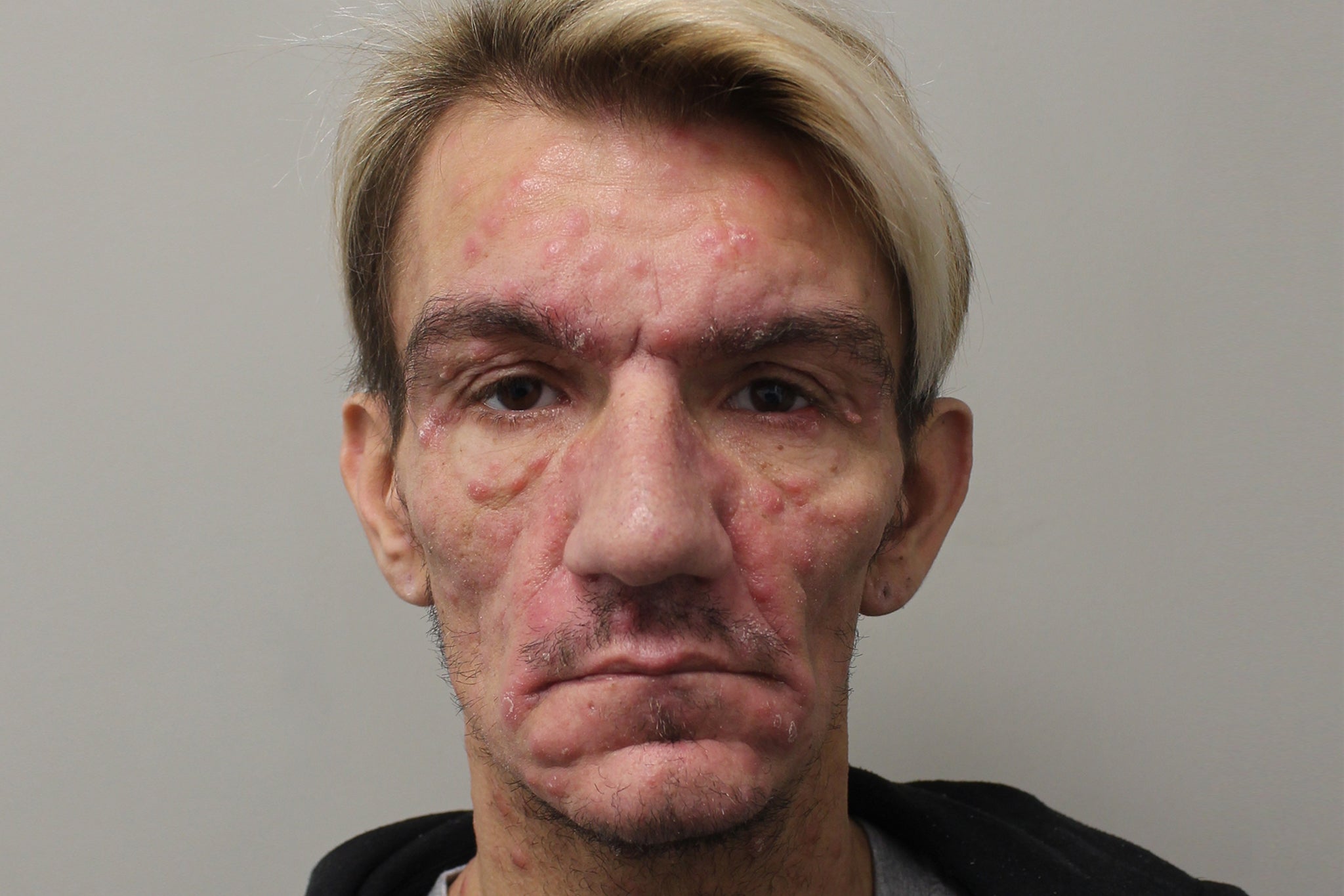 Jonathan Carl has been jailed for 17 years for raping a man and recklessly transmitting a sexual disease