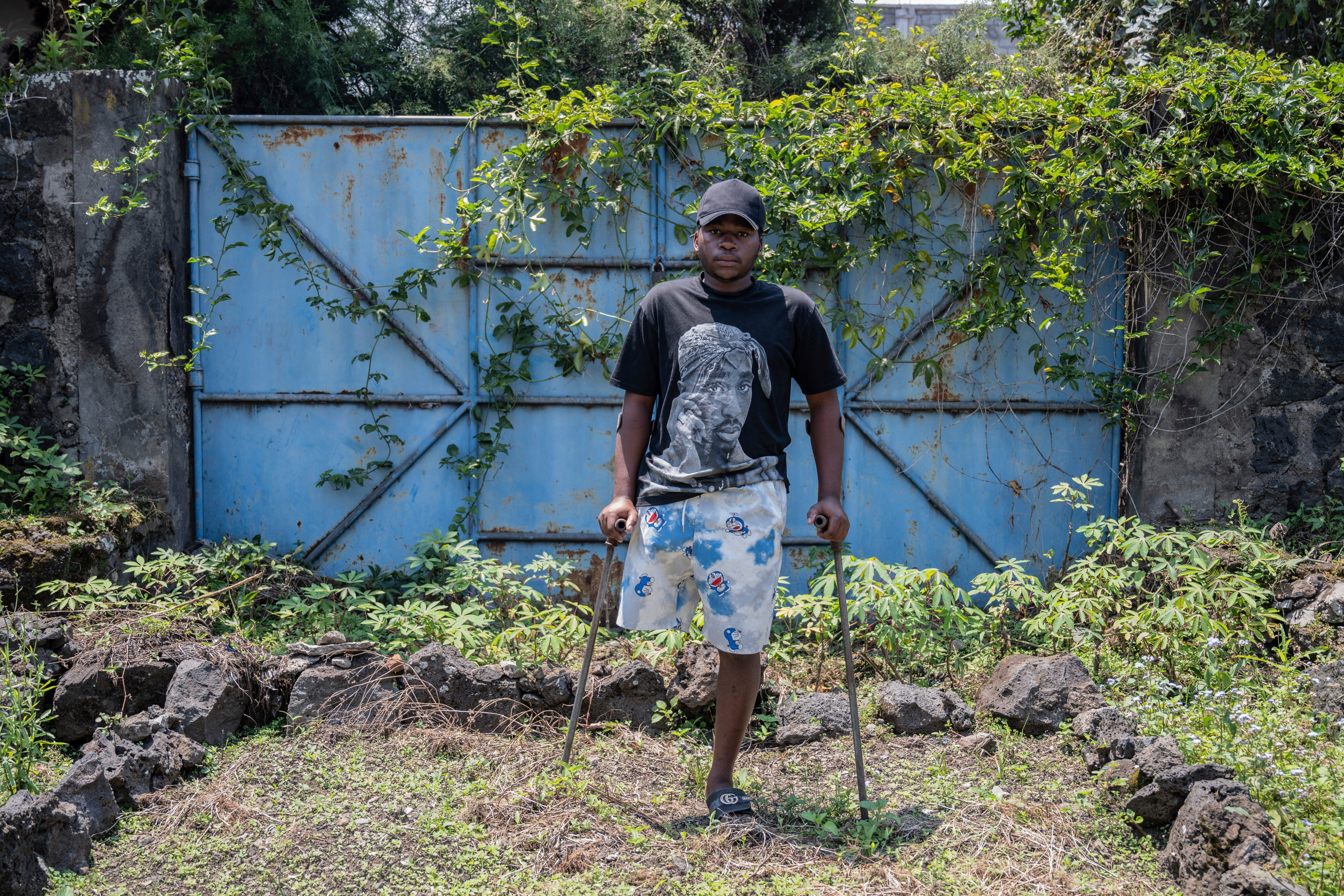 Congo Conflict Injured