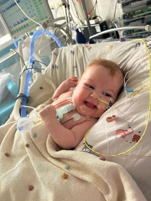 Six-month-old Rory Fletcher is on the urgent heart transplant waiting list