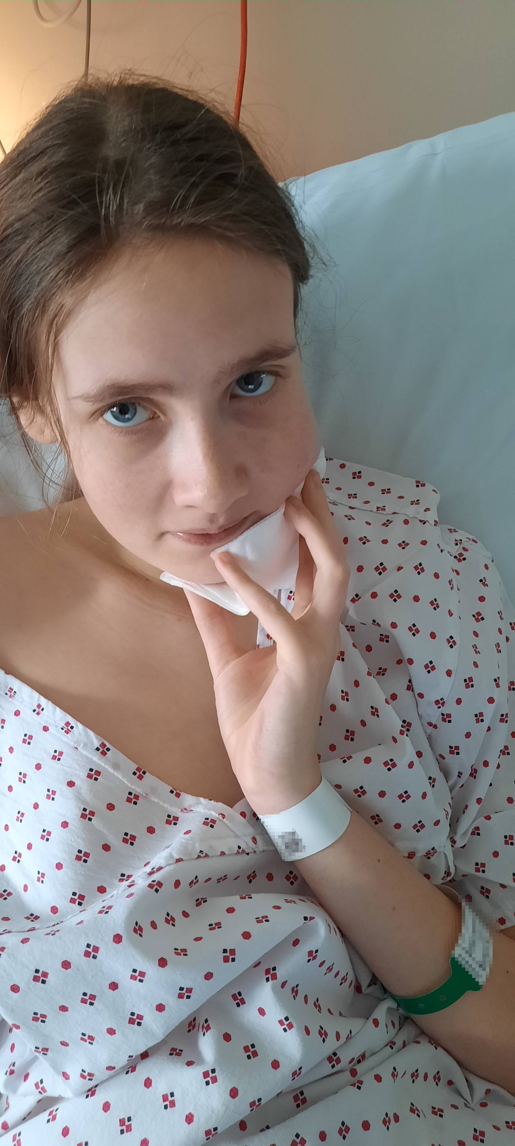 Katelyn De Blick had surgery under general anaesthetic at Bradford Royal Infirmary, where medics removed the tooth and drained the abscess from the outside, leaving her with a “painful” open wound for weeks and a 50p-sized scar