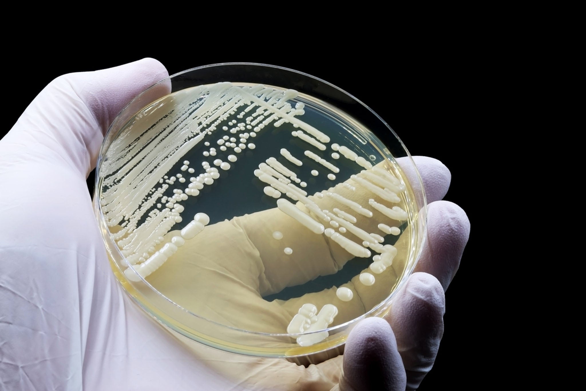 Candida auris has now been found in at least 61 countries