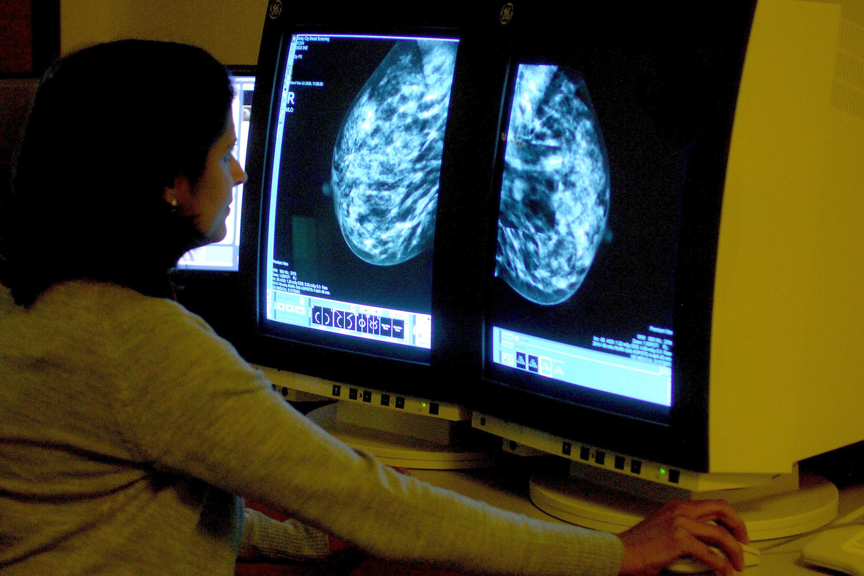 Mammograms can detect breast cancer early, often before a lump can be felt