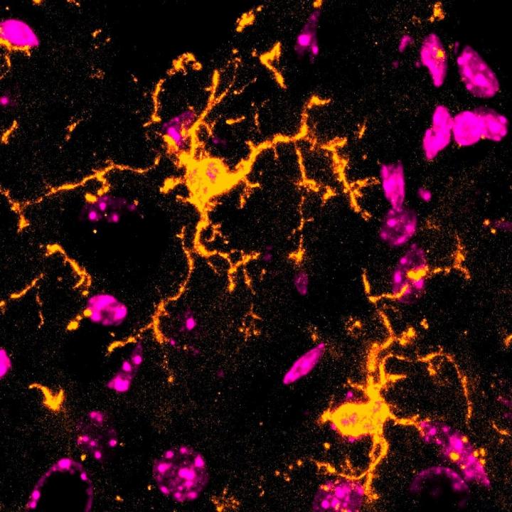 Microglia cells