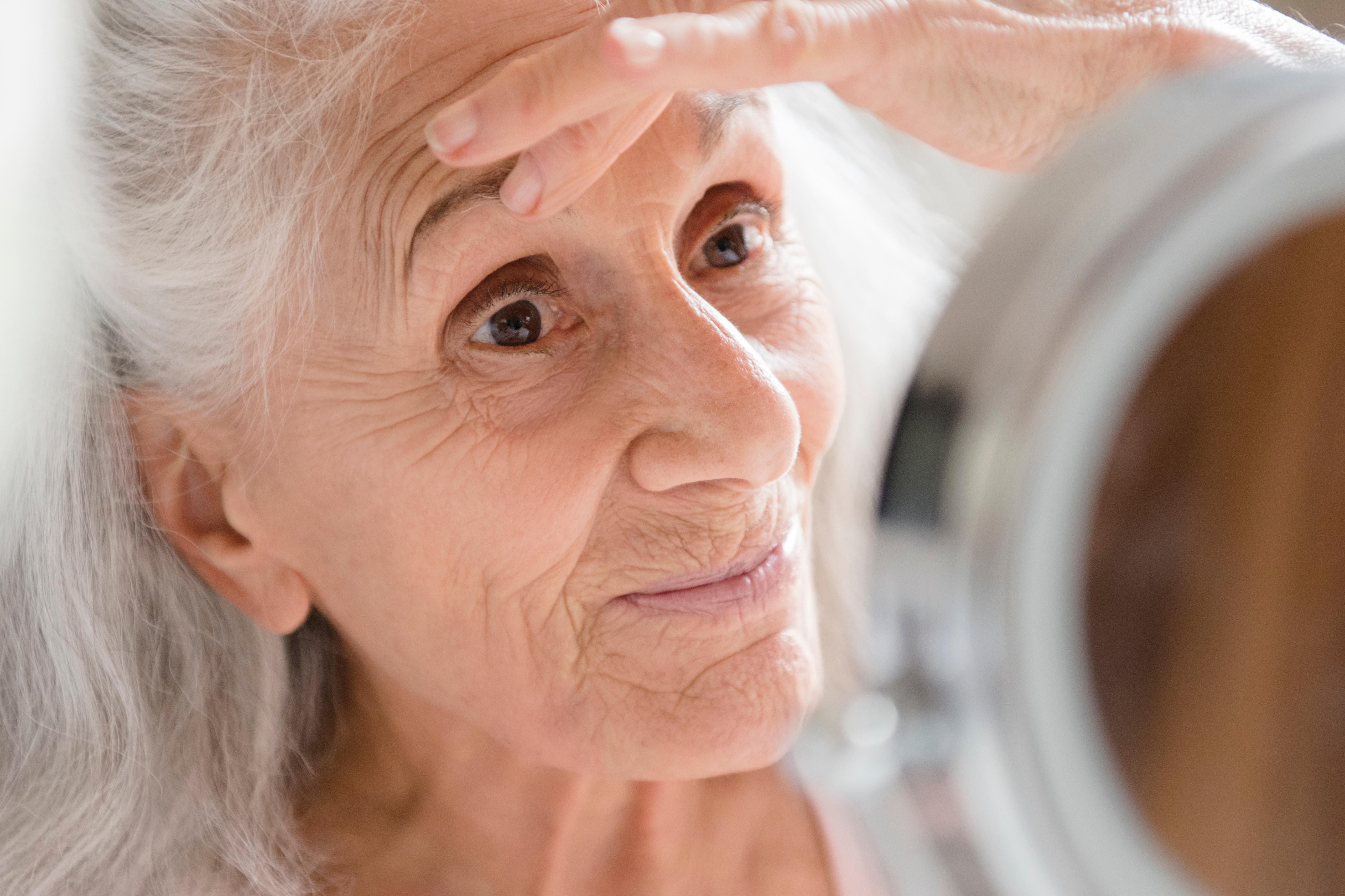 Scientists warned wrinkles around the eyes are linked to dementia