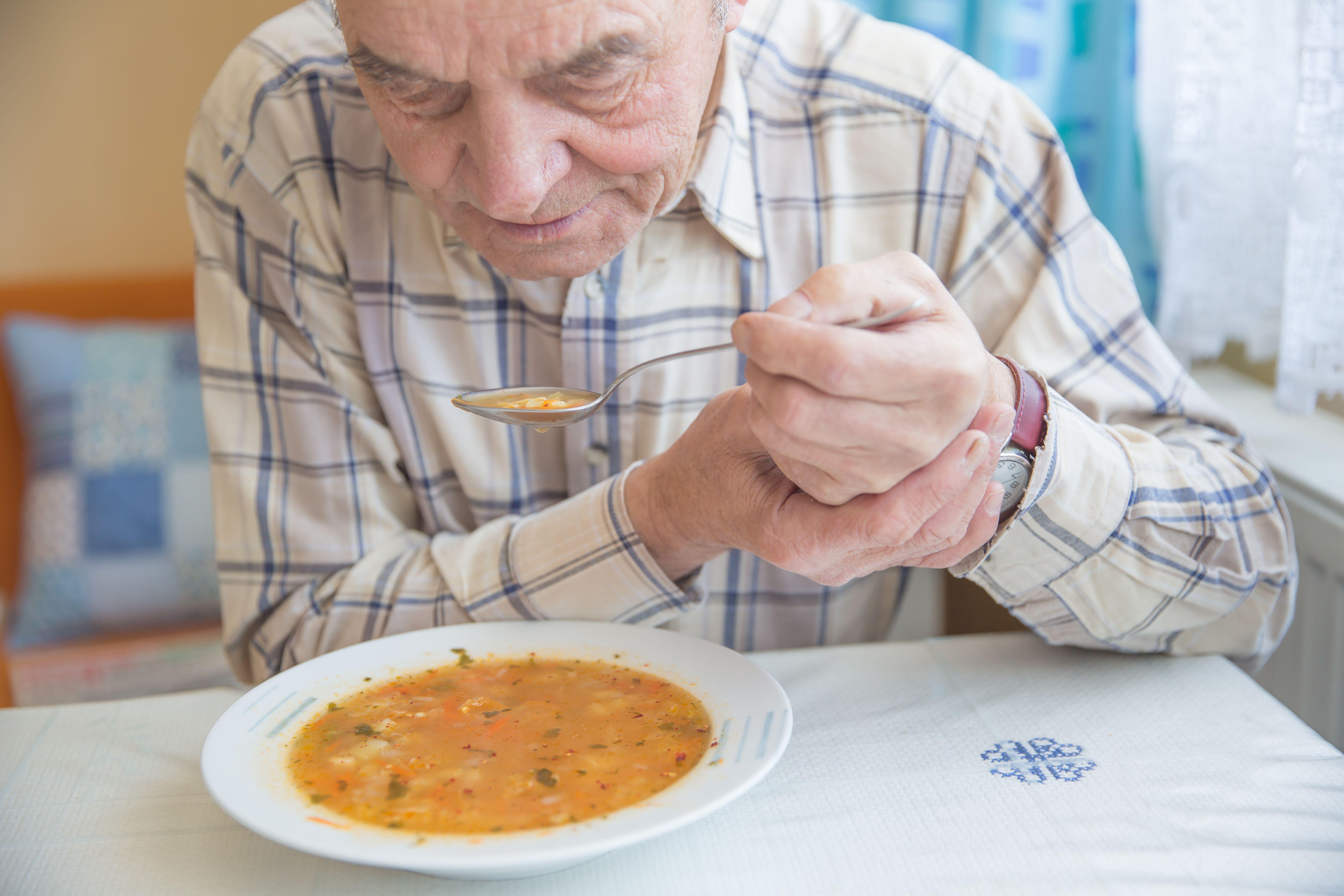 Parkinson’s is a neurodegenerative condition