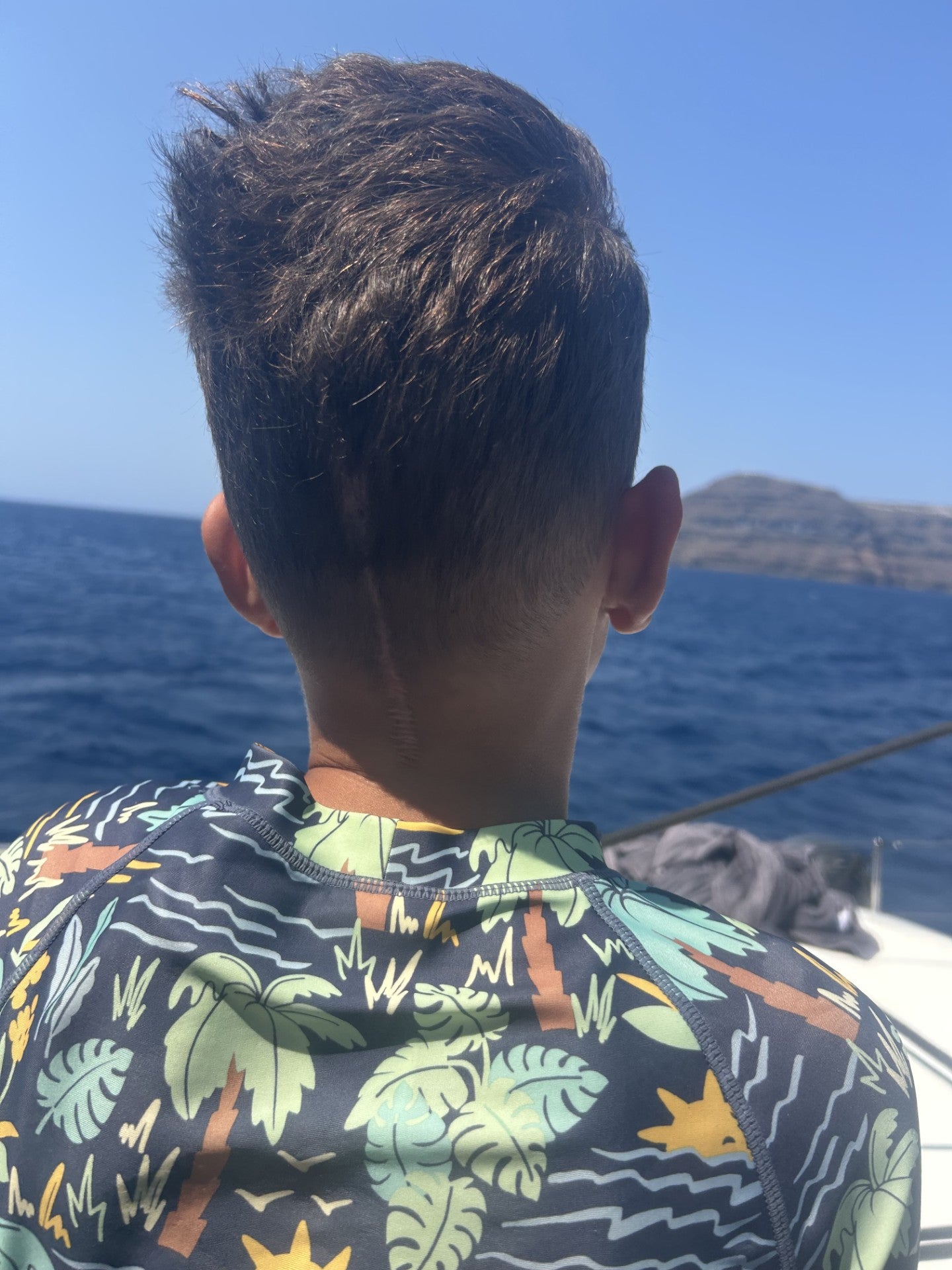 Harrison now has a scar on the back of his head