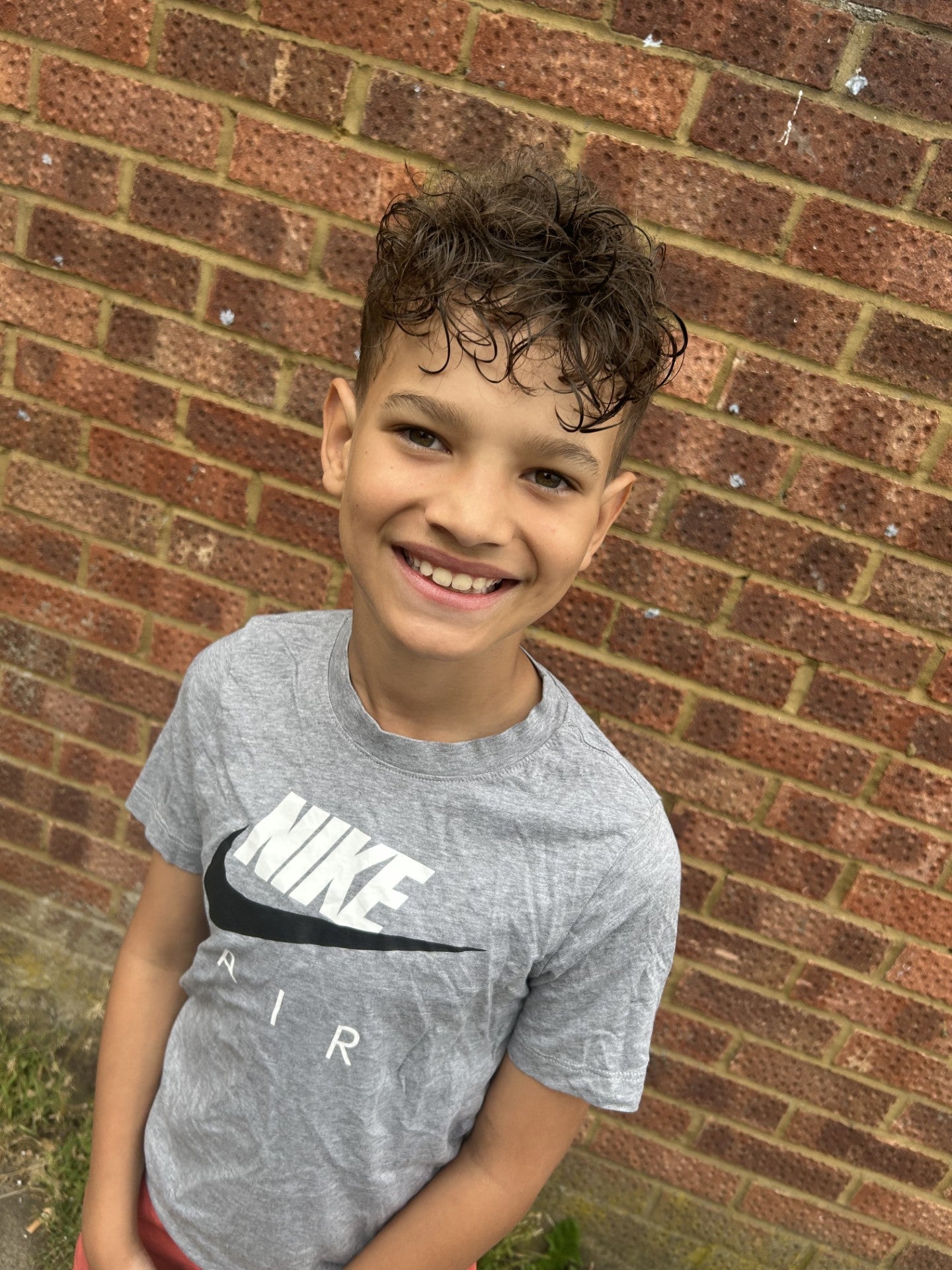 Harrison underwent brain surgery for an arteriovenous malformation (AVM) – a rare and life-threatening condition where blood vessels in the brain become dangerously tangled