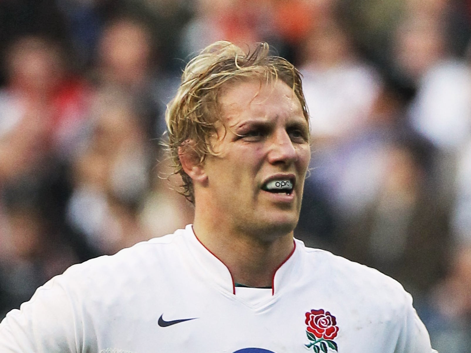 A 2022 study found that rugby players are at increased risk of the disease