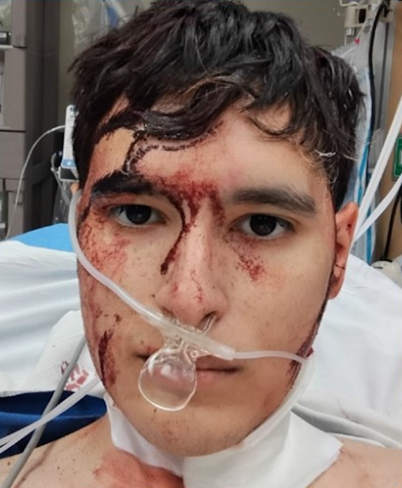 Quintanilla was stabbed six times in the head, neck, and arm before other passengers restrained the attacker. He is recovering and is expected to survive
