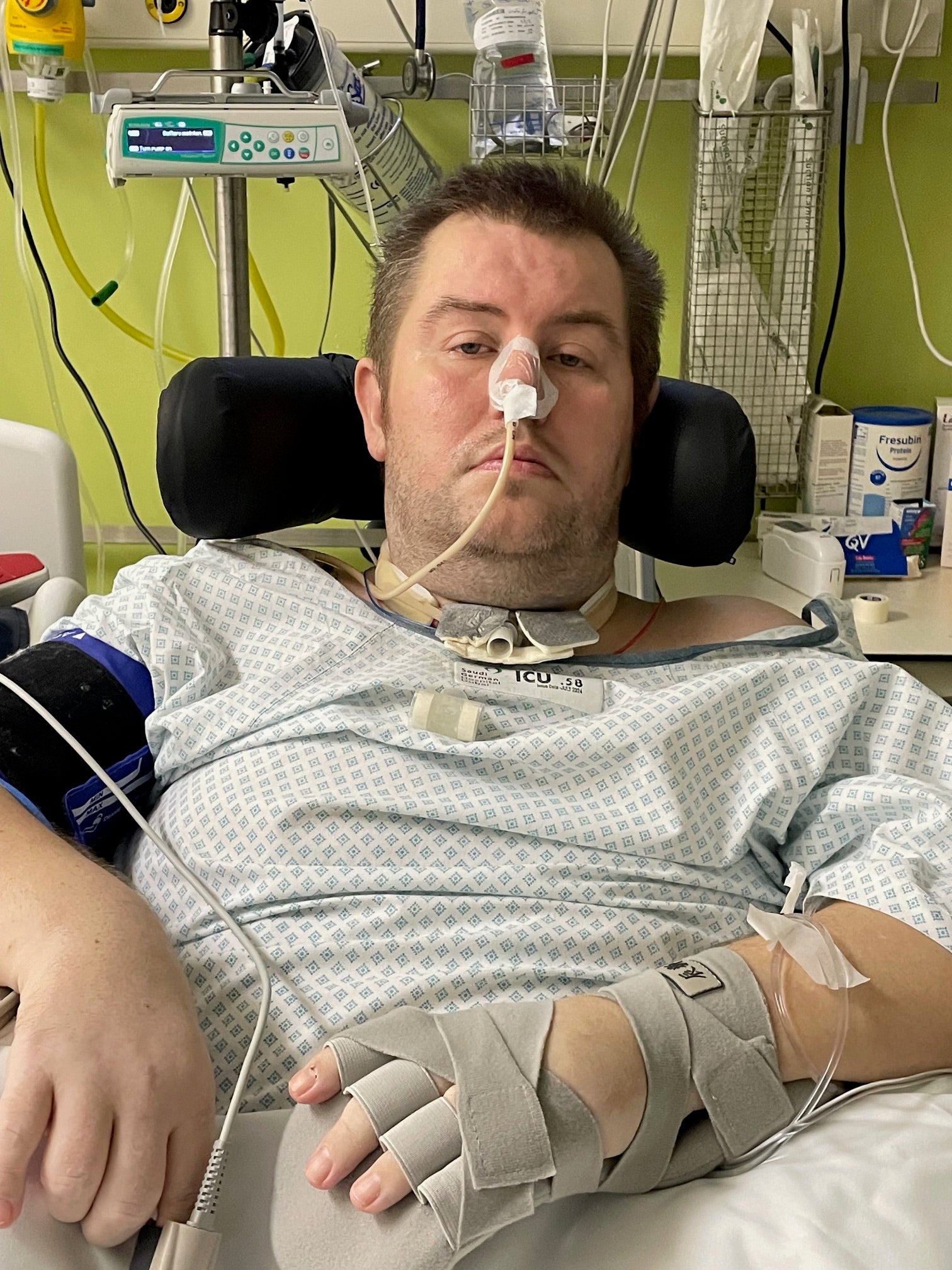 Martin is currently in Moseley Hall Hospital, Birmingham, which specialises in brain injury patients