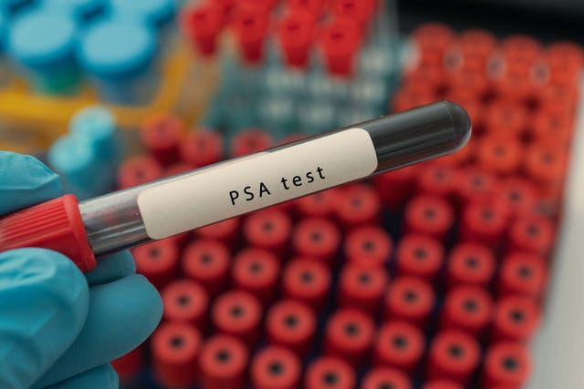 <p>A new poll has gauged public support for a prostate cancer screening programme</p>