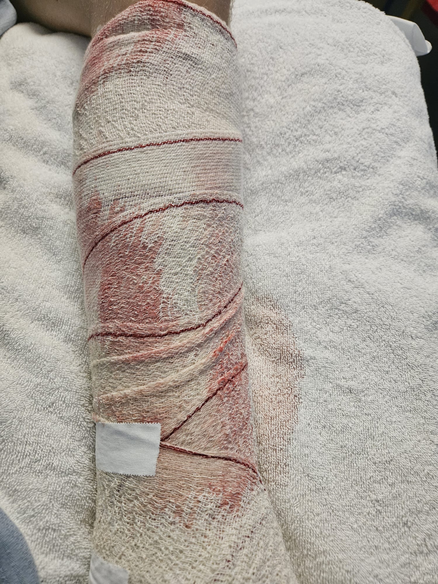 Shayne’s wound was ‘oozing a lot’