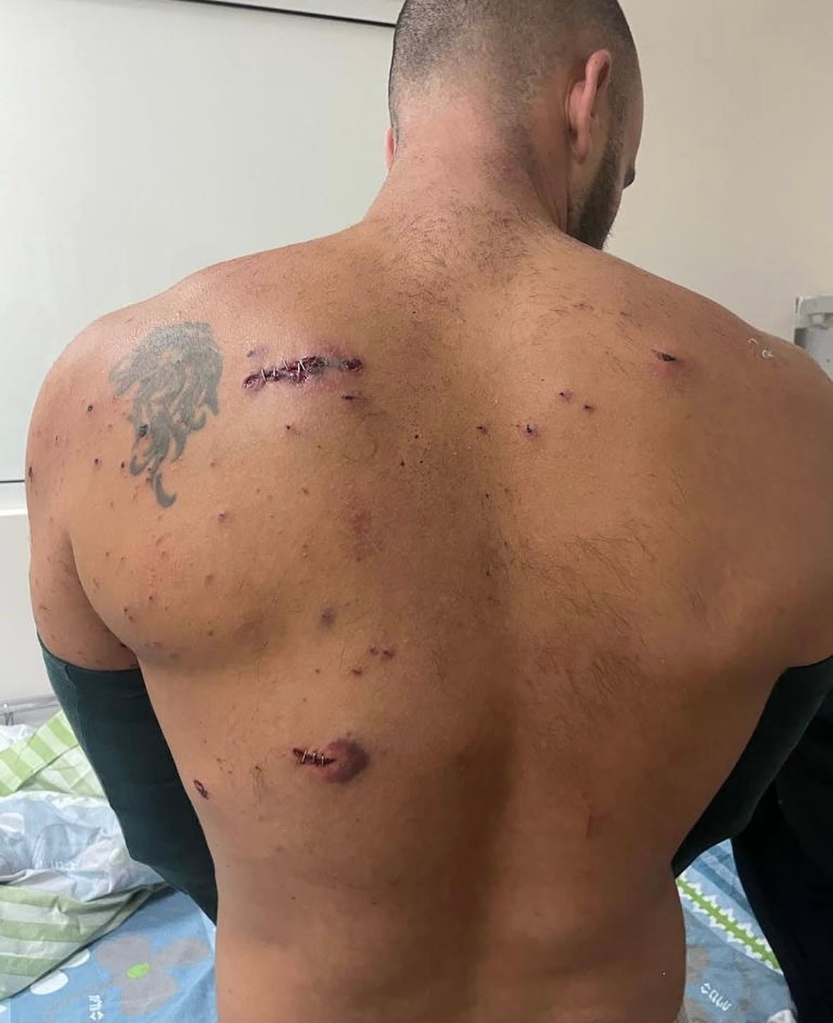 He was shot twice in the back while trying to shield his girlfriend