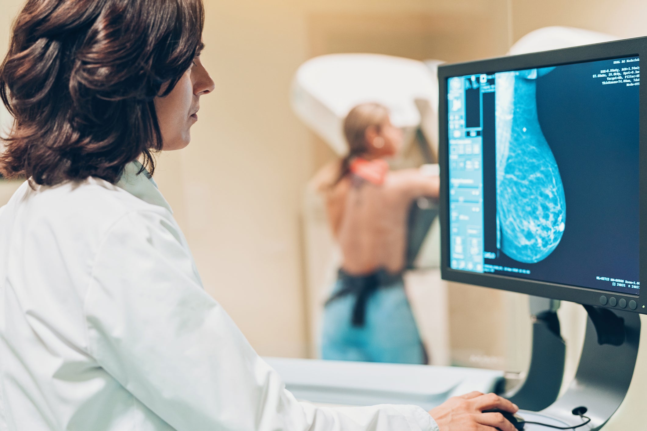 It is harder to detect abnormalities in women with dense breast tissue on a mammogram.