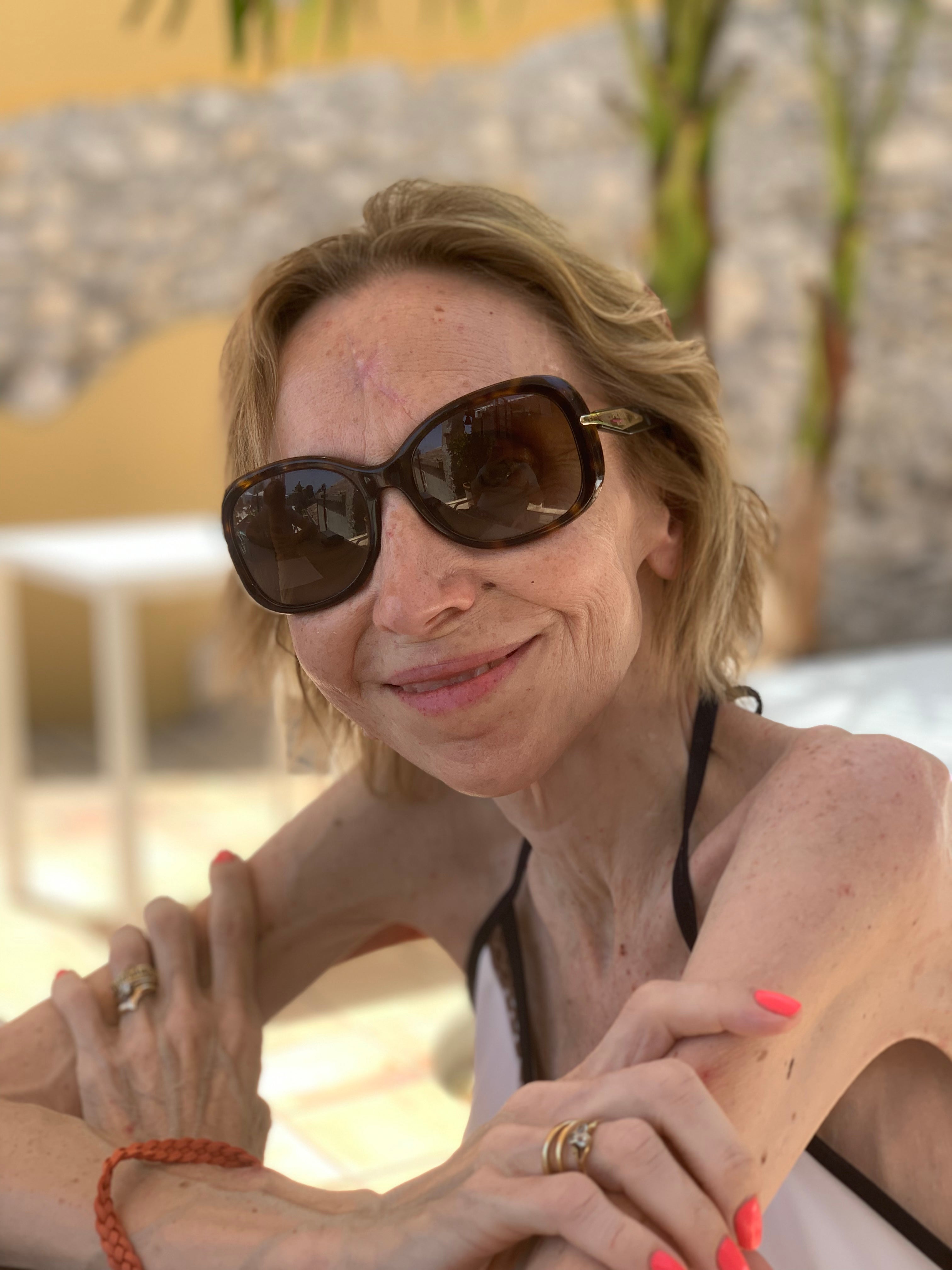 Hannah Fletcher: ‘Tests in the United States found asbestos fibres in a tumour in the lining of the abdomen, and my lawyer established that my only possible exposure was through talc’