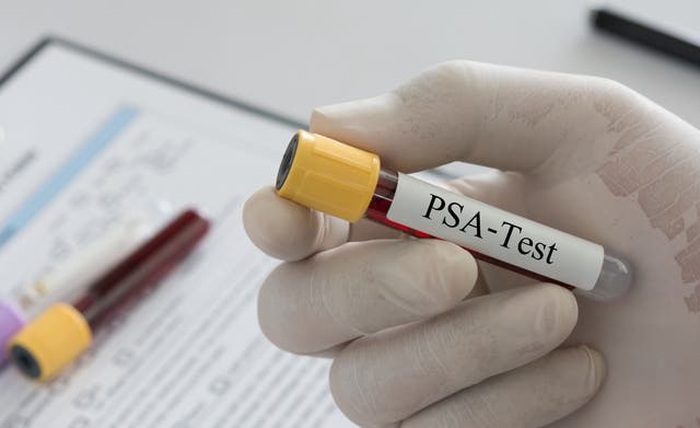 <p>advertising watchdog bans adverts for at-home PSA tests (stock image)</p>