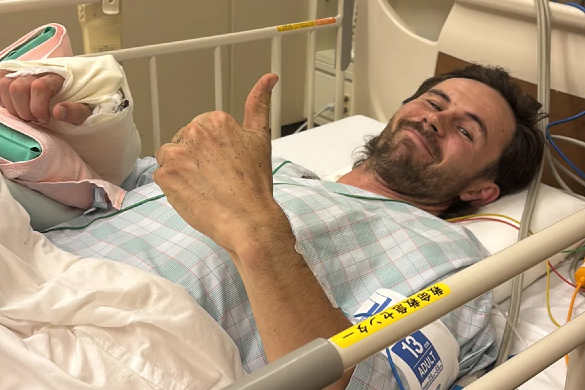 Billy Halloran from New Zealand survived a bear attack in Japan