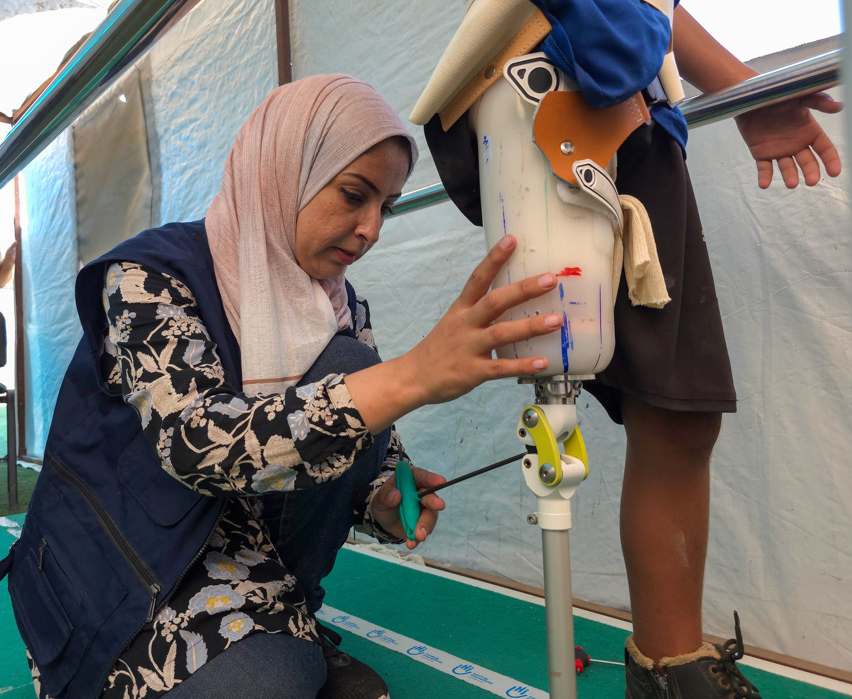 Heba examines people’s amputations, measures their stumps and makes moulds for both leg and arm prostheses.
