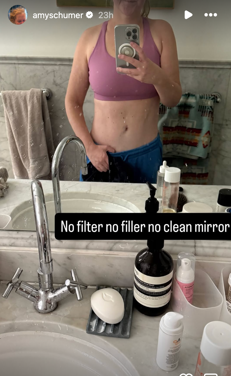 Amy Schumer shows off toned stomach amid weight loss journey