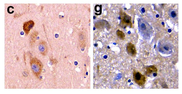 c) Beta-amyloid pathology in a stranded dolphin brain g) tau protein in the brain of a stranded dolphin