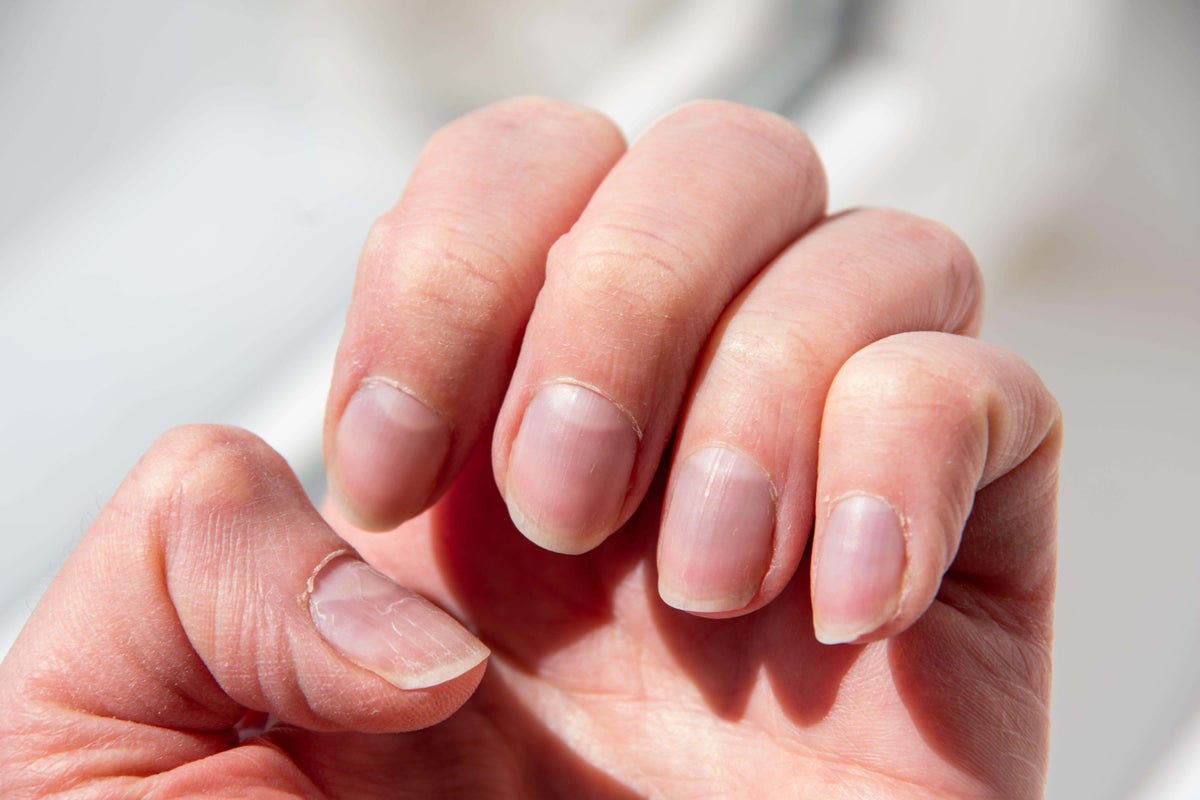 What the look of your nails says about your health What the look of your nails says about your health
