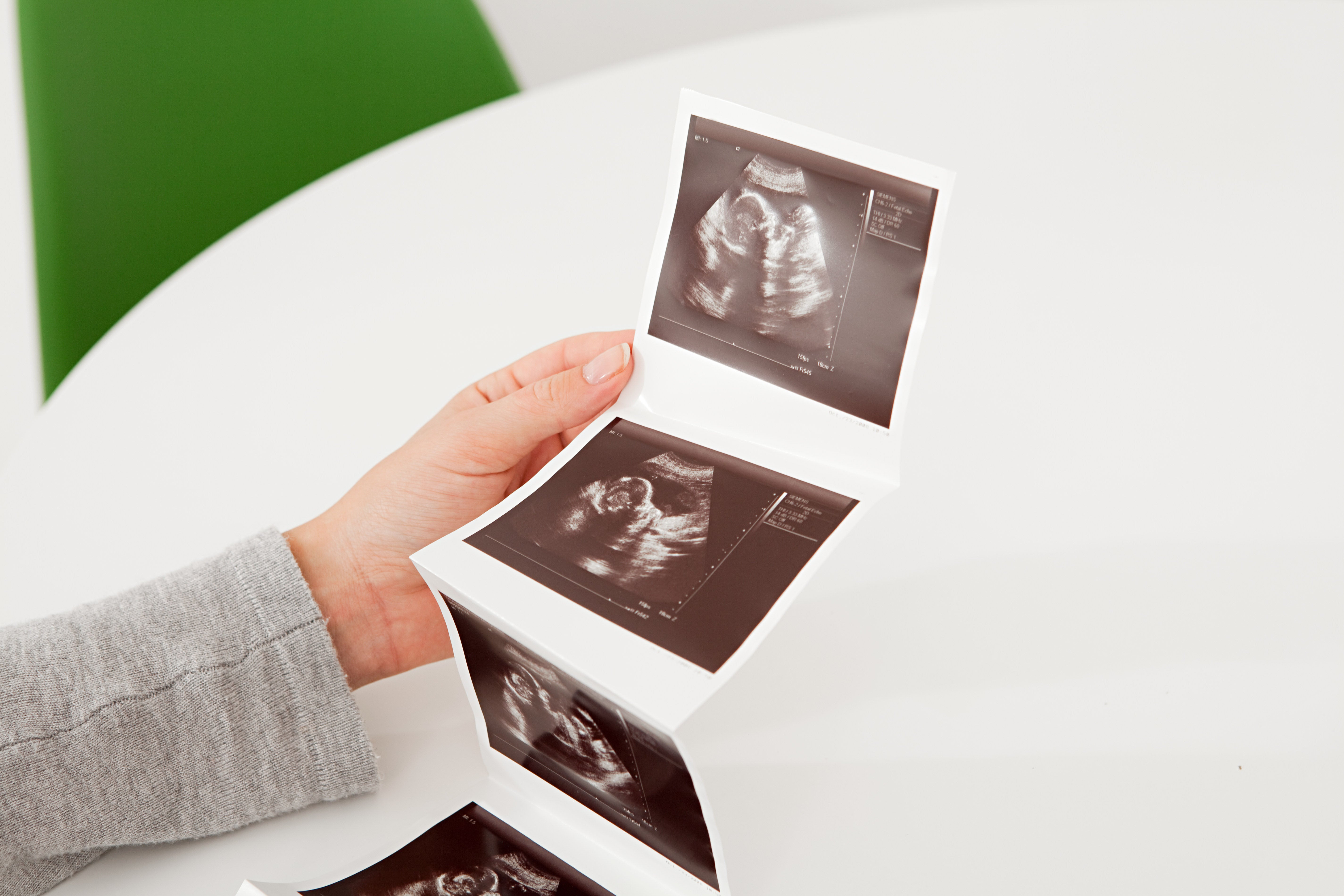 The Society of Radiographers said some high-street baby-scan clinics are offering ultrasound scans conducted by non-specialists