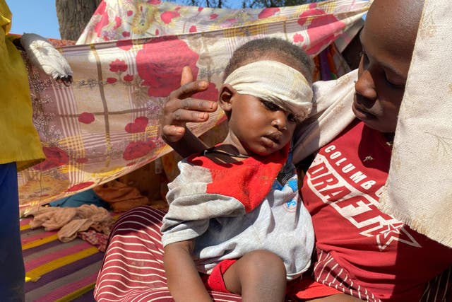 <p>A Sudanese child who fled el-Fasher city with family after Sudan's paramilitary forces killed hundreds of people in the western Darfur region, receives treatment at a camp in Tawila, Sudan</p>