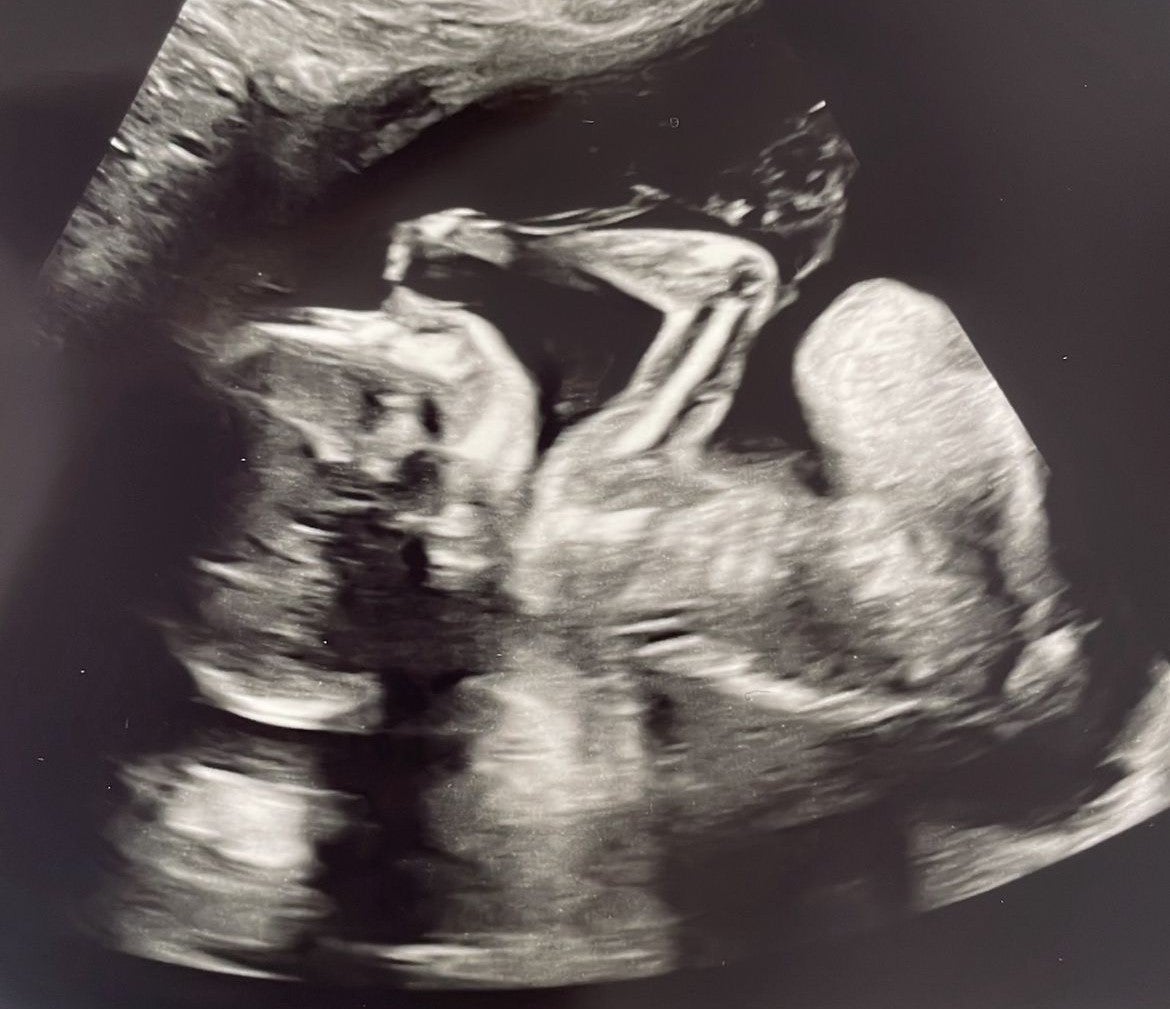 Dítě Ezra v děloze