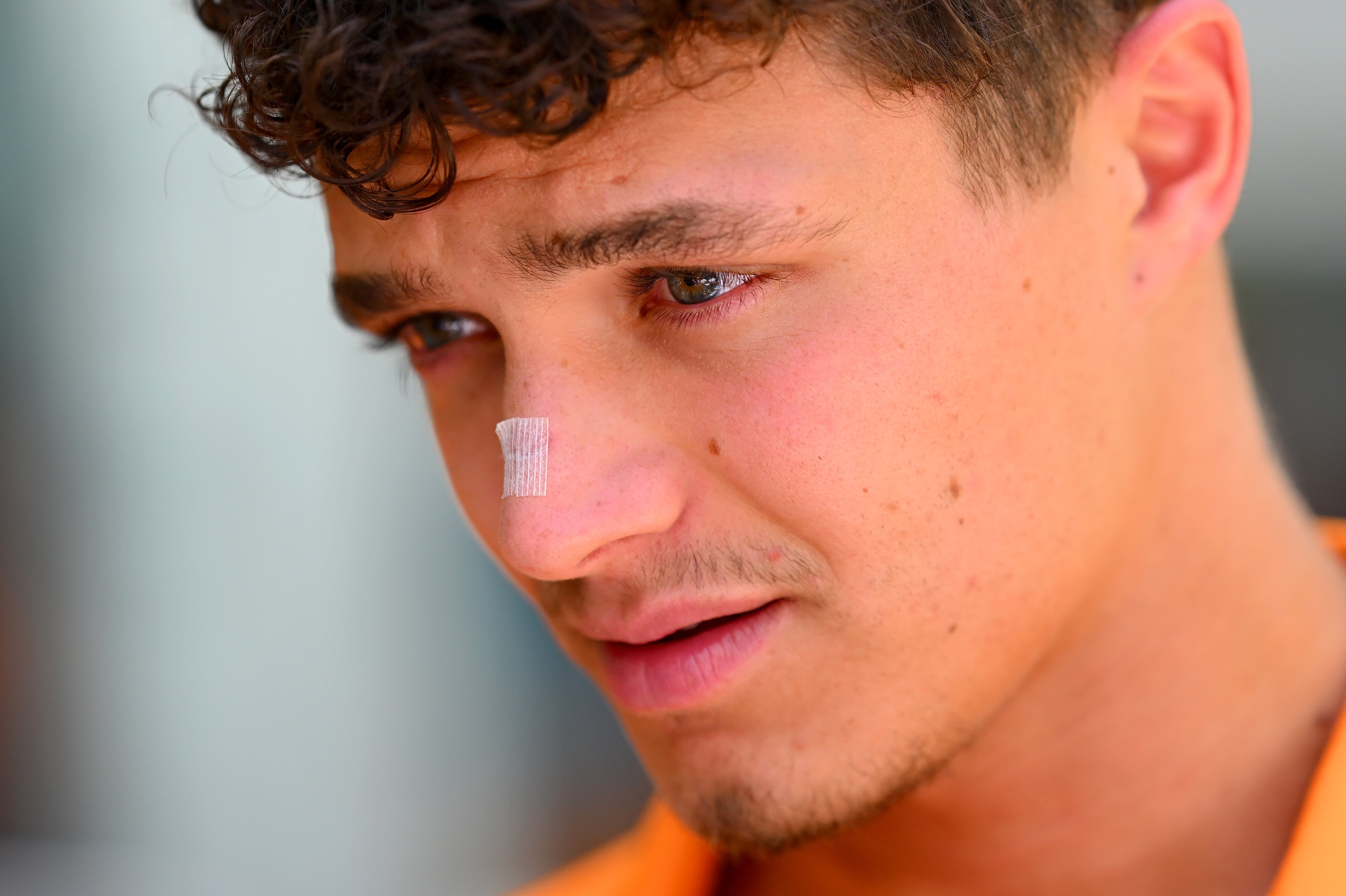 Norris cut his nose partying in Amsterdam last year