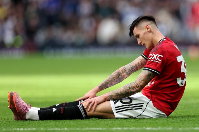 <p>Benjamin Sesko suffered an injury during Manchester United's draw with Tottenham Hotspur</p>