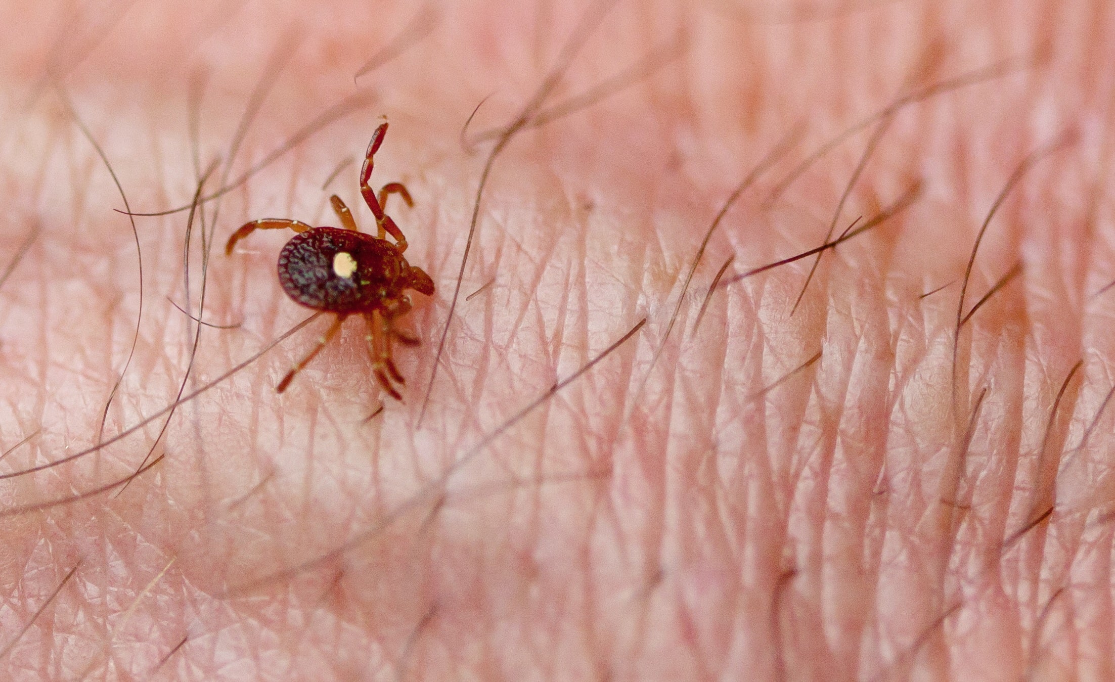 Doctors believe a 47-year-old New Jersey man died after being bitten by lone star tick larvae and eating red meat
