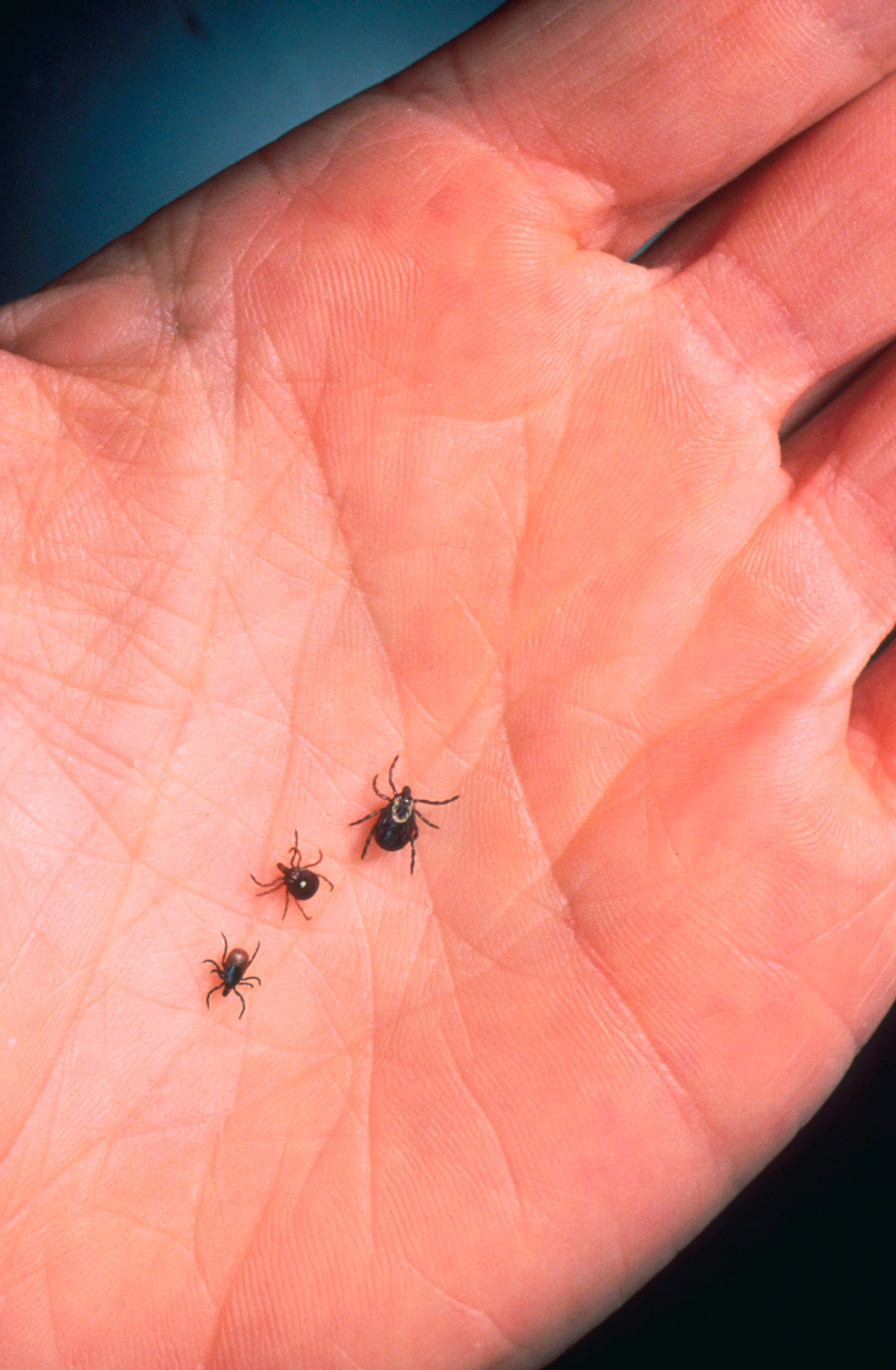 While it was previously believed that alpha-gal syndrome was solely tied to lone star ticks, researchers have identified two other species that can elicit an allergic reaction