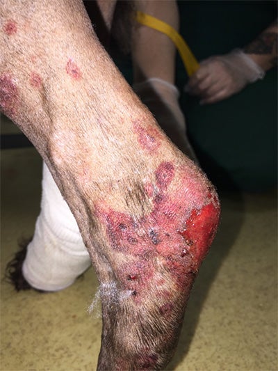 It can cause skin lesions to form, most commonly appearing on the dog's distal limbs, paws, or lower abdomen. A dog with the disease may also show signs of localized swelling, redness, or even crusting