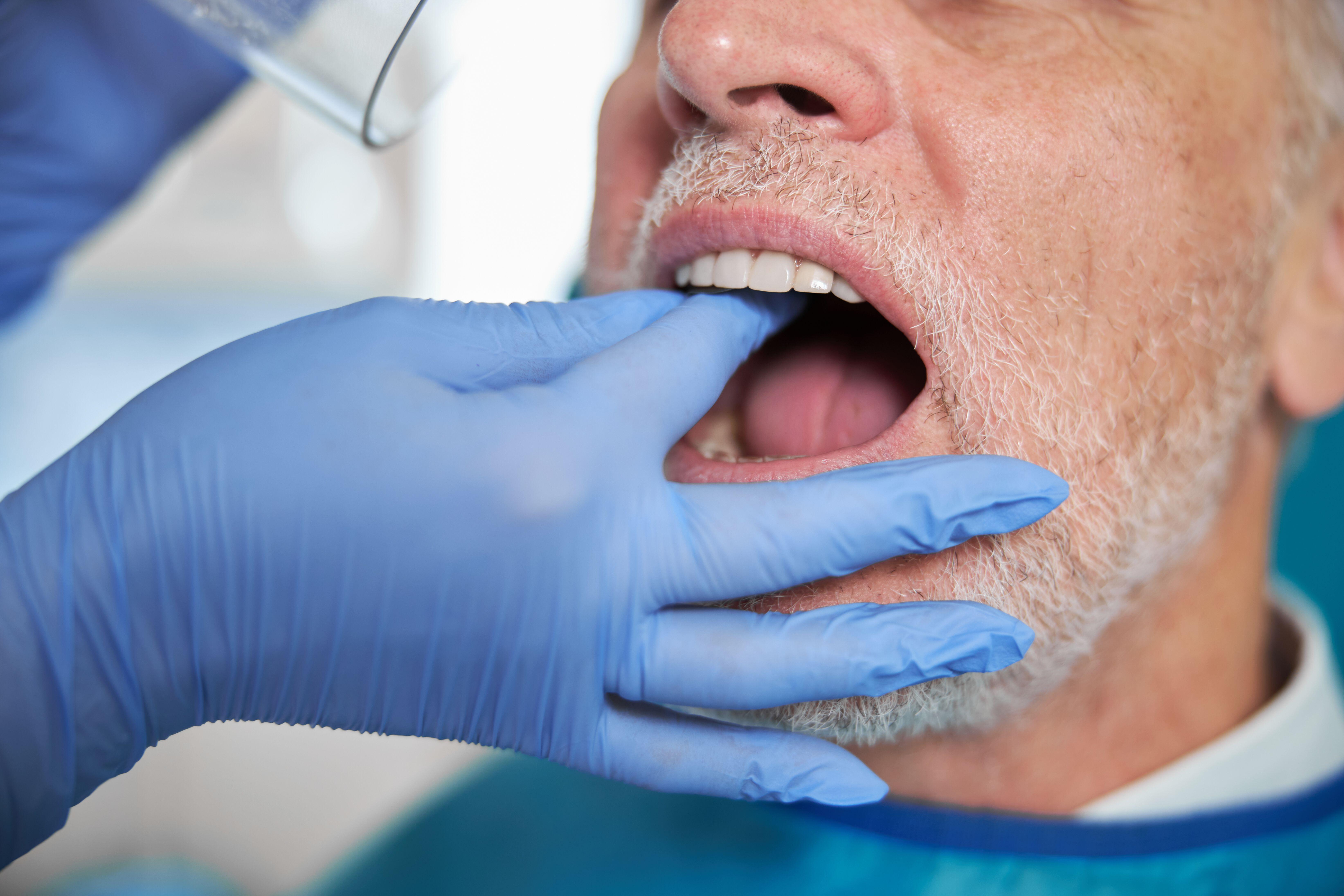 Nearly half of adults show signs of rotting teeth