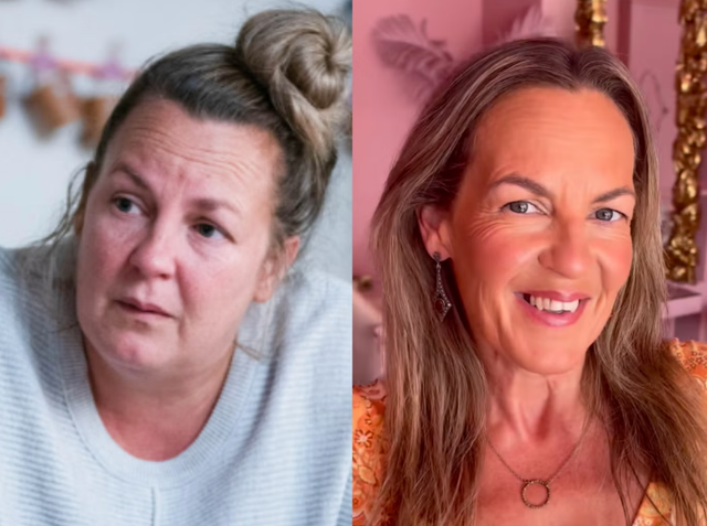 <p>Lorraine Stanley put on a whopping seven stone with surgery - and now regrets it </p>