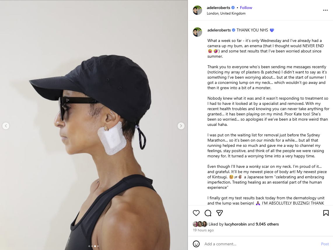 Presenter and reality TV star Adele Roberts has said she is “absolutely buzzing” after learning that a “concerning” lump removed from her neck was benign