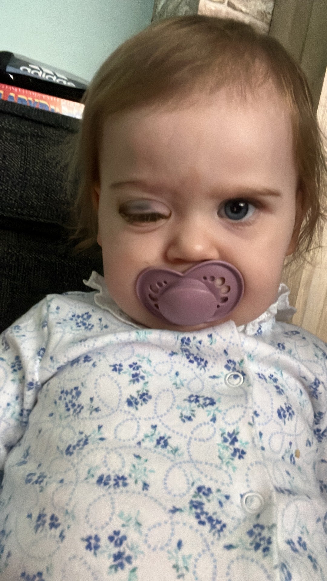 ‘There wasn’t anything they could do to save the eye’