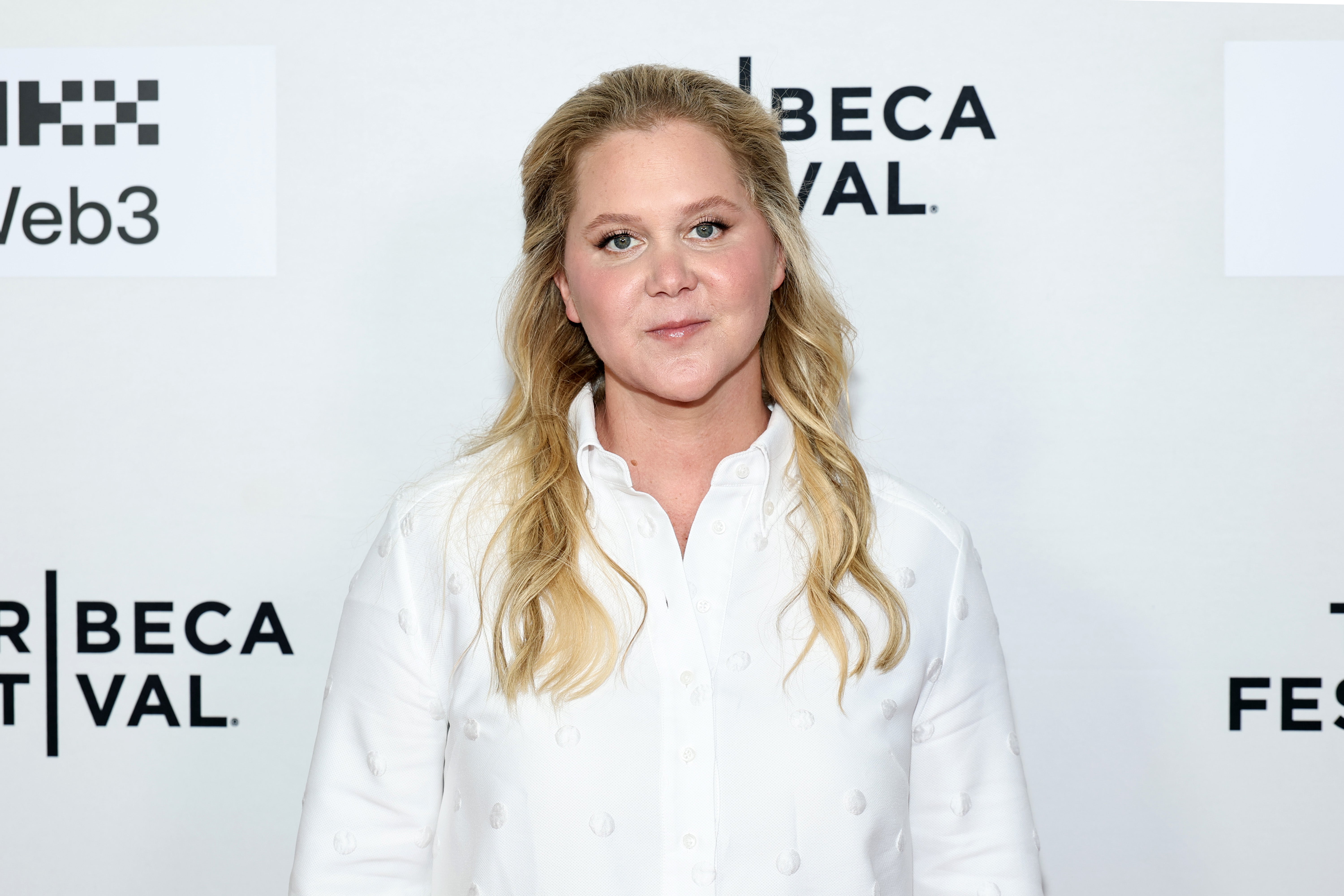 Amy Schumer says she lost weight because of a disease she had that could ‘kill’ her