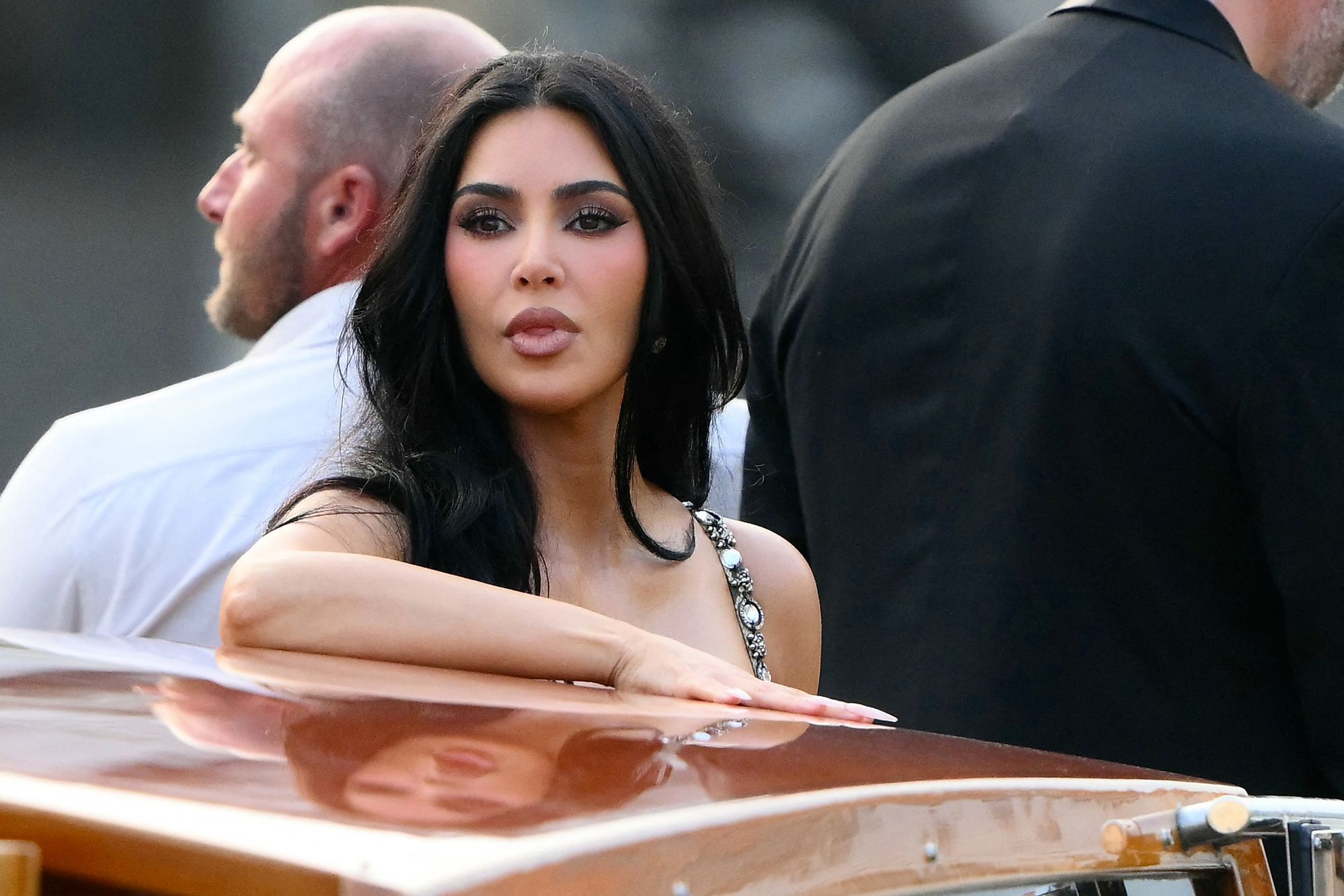 Kim Kardashian was diagnosed with a brain aneurysm following an MRI scan