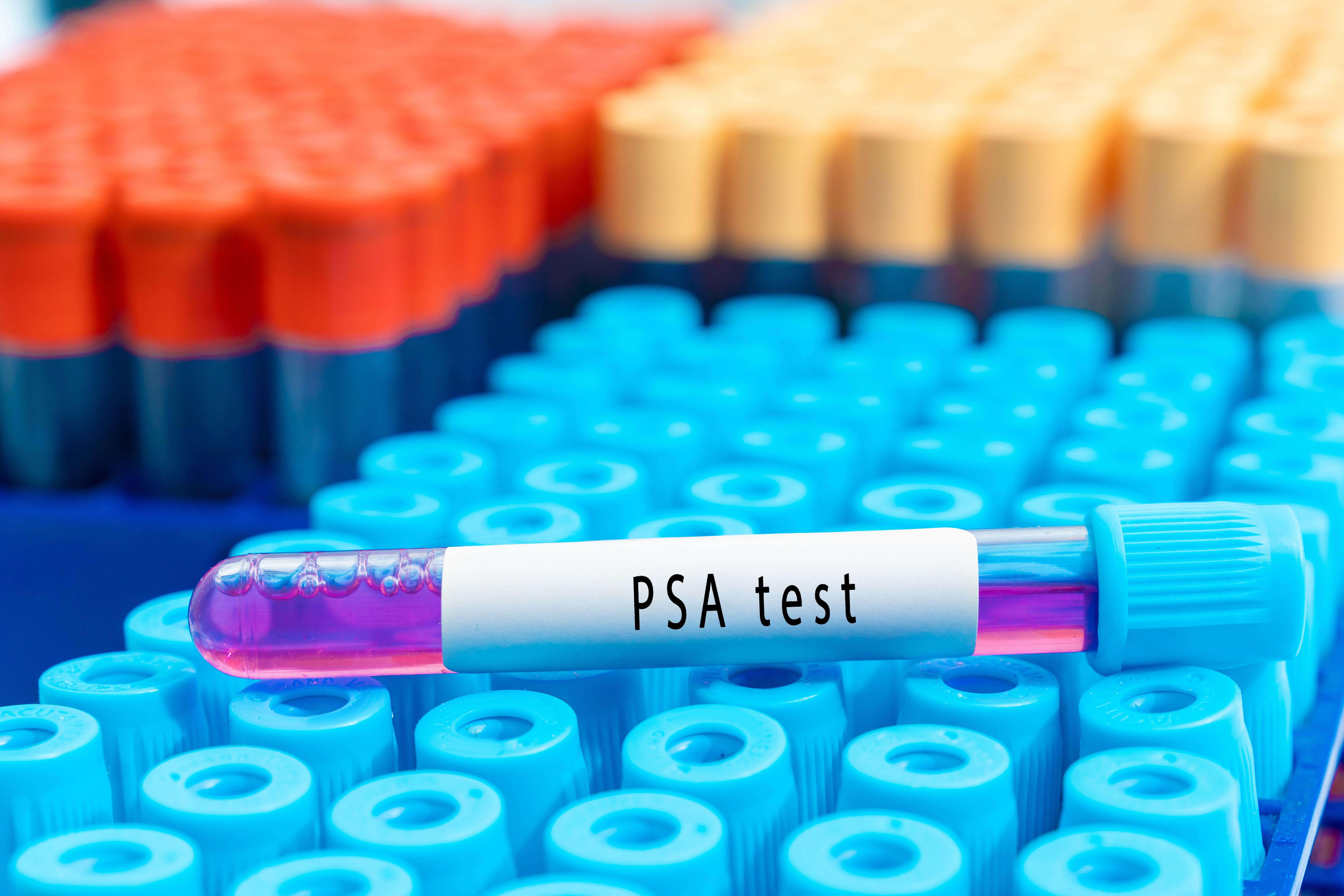 At home prostate test adverts have been banned